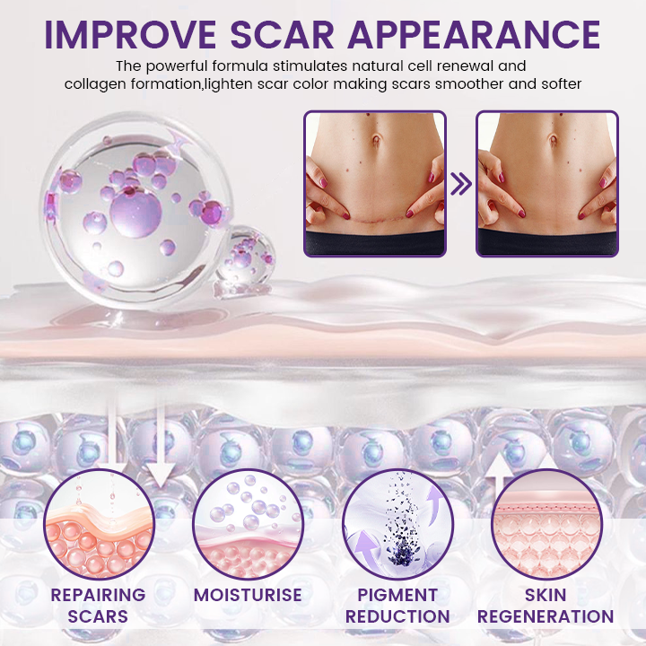 Timilk® ReGenScar topical scar gel